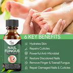 Nail Repair Essence Serum 10ml – Nail Care & Conditioning Liquid for Toenails & Fingernails | Nail Appearance Care & Maintenance Oil