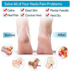 Silicone Heel Protector (2 Pcs) | Soft Heel Pad Silicone & Heel Cushion Sleeve | Heel Cover and Heel Guard for Daily Heel Comfort