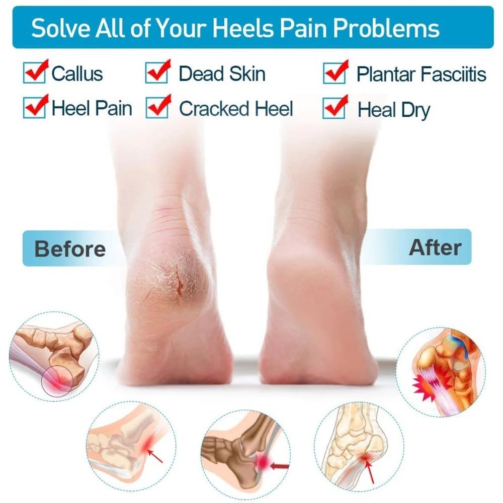 Silicone Heel Protector (2 Pcs) | Soft Heel Pad Silicone & Heel Cushion Sleeve | Heel Cover and Heel Guard for Daily Heel Comfort