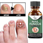 Nail Repair Essence Serum 10ml – Nail Care & Conditioning Liquid for Toenails & Fingernails | Nail Appearance Care & Maintenance Oil