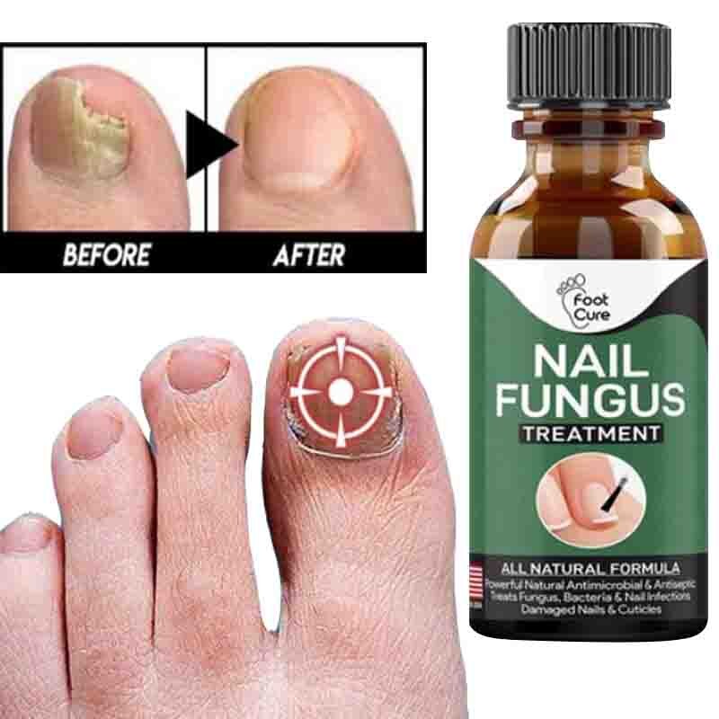 Nail Repair Essence Serum 10ml – Nail Care & Conditioning Liquid for Toenails & Fingernails | Nail Appearance Care & Maintenance Oil